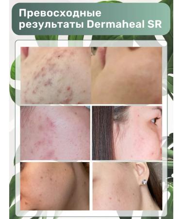 SRMAHIL SR serum against acne and wrinkles 5 pcs - Buy Online on GoSupps.com