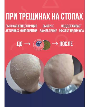 ROSILAK Foot cream - Buy Online on GoSupps.com