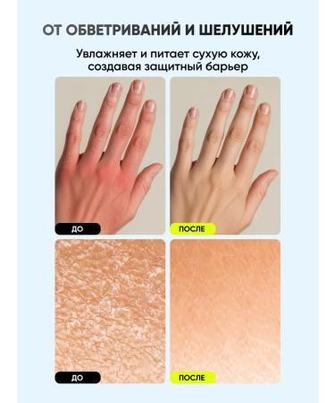 Althea Cream from cracks and dryness moisturizing - Buy Online on GoSupps.com