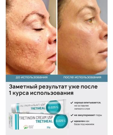 Secrets of India Tretinoin cream from acne and acne USP 0.025% - Buy Online on GoSupps.com