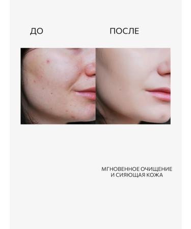 Lamar Professional Micellar Clean Collagen Micellar Gel 200ml - Buy Online on GoSupps.com