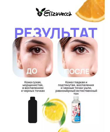 Elizavecca Korean face tonic from black dots - Buy Online on GoSupps.com