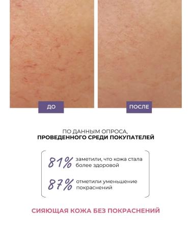 Lamar Professional Face cream capillaroprotector moisturizer from acne - Buy Online on GoSupps.com