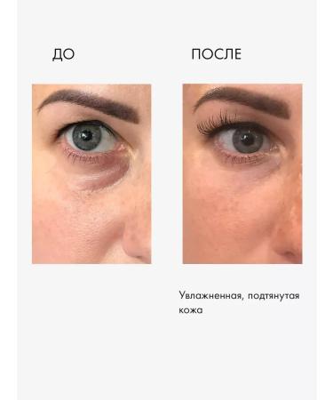 Lamar Professional Meso Face Moster moisturizing hyaluronic from wrinkles - Buy Online on GoSupps.com