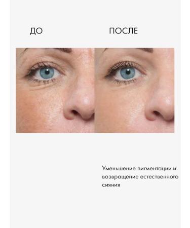 Lamar Professional Face mask lifting against wrinkles and pigmentation - Buy Online on GoSupps.com