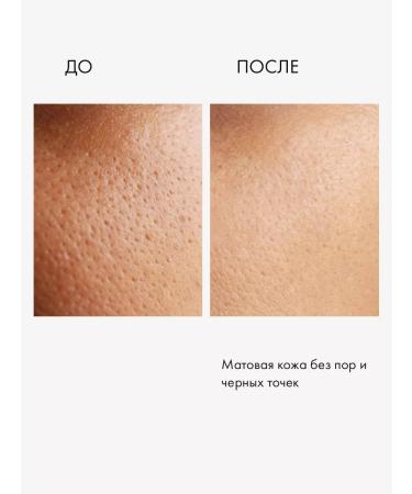 Lamar Professional Pimpling and pigmentation whey and pigmentation - Buy Online on GoSupps.com