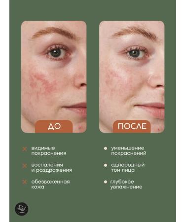 KRASNOPOLYANSKAYA COSMETICS Hydrolat for face and hair moisturizing natural calendula - Buy Online on GoSupps.com