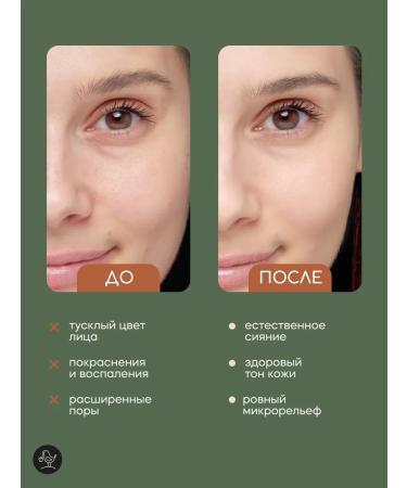 KRASNOPOLYANSKAYA COSMETICS Hydrolat for face and hair moisturizing natural lemon - Buy Online on GoSupps.com