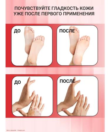 Moisturizing and nutritious hands and legs cream - Buy Online on GoSupps.com