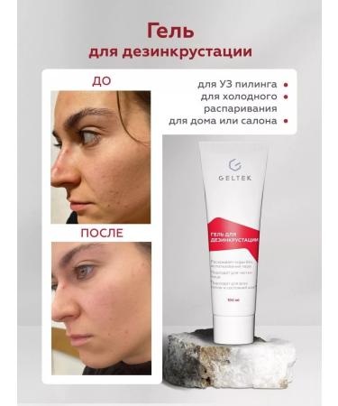 Gel for ultrasonic facial cleansing Uzes 100 ml