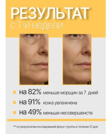 BELITA Night and day face cream 70+ against wrinkles moisturizing - Buy Online on GoSupps.com