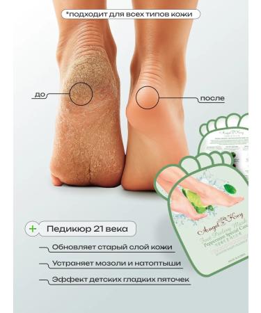 Angel Key Piling Pedicier toes for the legs the mask exfoliates 5 pcs - Buy Online on GoSupps.com