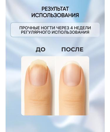SOPHIN Nail fortifier with keratin Therapeutic - Buy Online on GoSupps.com