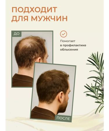 HomeSpa Serum therapeutic for hair growth remedy for falling out - Buy Online on GoSupps.com
