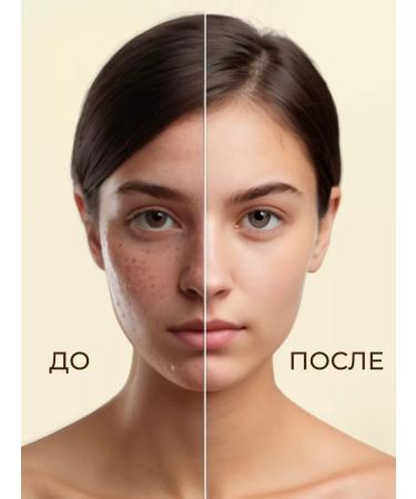 NADUK Facial serum care from acne and acne - Buy Online on GoSupps.com
