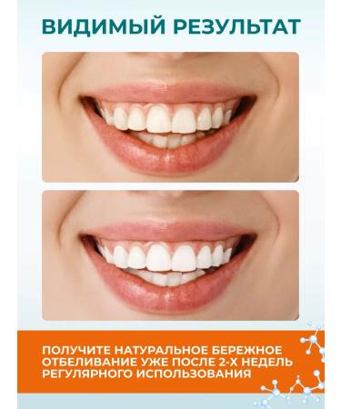 Himalaya Since 1930 Whitening toothpaste "white radiance" without fluorine 3 pcs - Buy Online on GoSupps.com