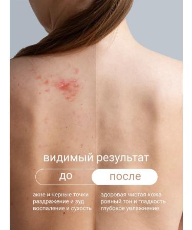 The Virgin Beauty Body cream from acne with retinol - Buy Online on GoSupps.com