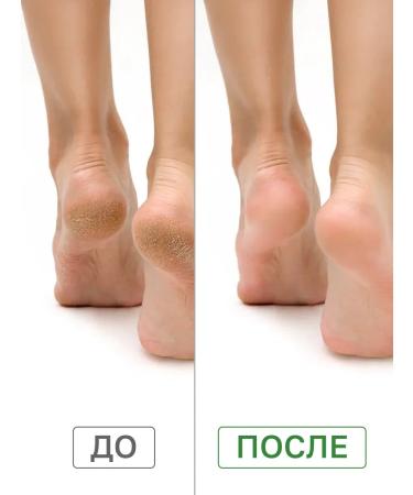 JAMEELAH Moisturizer with urea and aloe extract 500 ml - Buy Online on GoSupps.com