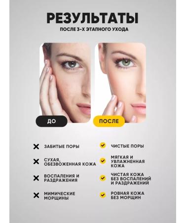 La & Te beaut A set of cosmetics for dry skin 3 subjects - Buy Online on GoSupps.com