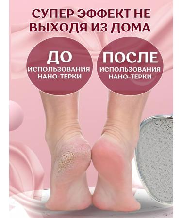 sheslyfchik Nano foot grater epilator - Buy Online on GoSupps.com