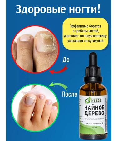 NEEGO Tea tree oil with vitamin E natural from acne - Buy Online on GoSupps.com