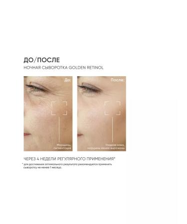 ICON SKIN Rejuvenating serum for the face with retinol - Buy Online on GoSupps.com