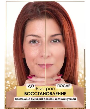 Jigott Face cream from rosacea rosacea red skin redness - Buy Online on GoSupps.com