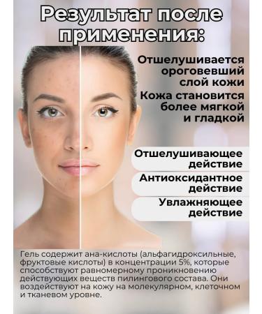 new peel Cleaning face gel 100 ml - Buy Online on GoSupps.com