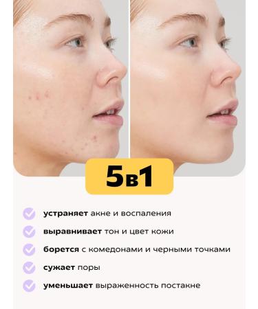 KRASNOPOLYANSKAYA COSMETICS The serum moisturizes for oily skin with niacinamide - Buy Online on GoSupps.com
