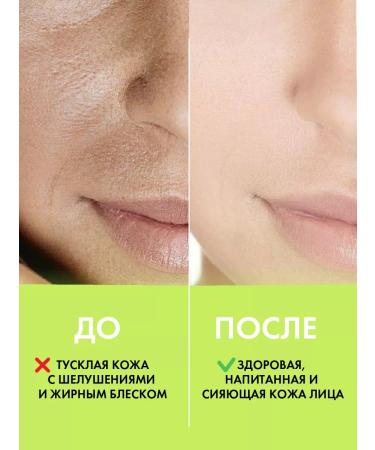 HOLLY POLLY Face tonic moisturizing from black dots 250 ml - Buy Online on GoSupps.com