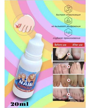 Beauty Moon Serum from nail fungus - Buy Online on GoSupps.com