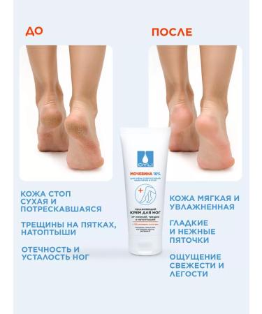 OYLI Foot cream 18% urea moisturizer from cracks and corns - Buy Online on GoSupps.com
