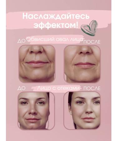 Sofid Oil from wrinkles pigmentation and edema - Buy Online on GoSupps.com