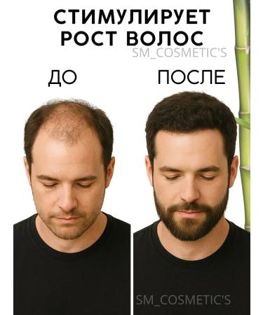 smcosmetic's Shampoo soap against hair loss - Buy Online on GoSupps.com