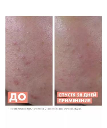 AVENE Updating serum for oily and problem skin - Buy Online on GoSupps.com