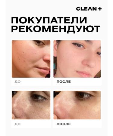 CLEANPLUS Acne Control face cream from acne 50 ml - Buy Online on GoSupps.com