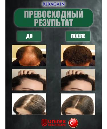 Unirex Healthcare Capixil Activator for hair growth Capixyl 5% - Buy Online on GoSupps.com