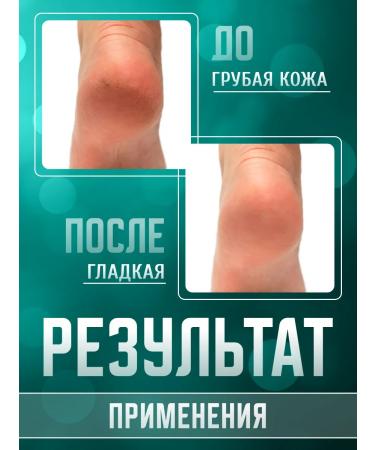 Spring Feet cream is a healer 2 pcs 45 ml - Buy Online on GoSupps.com