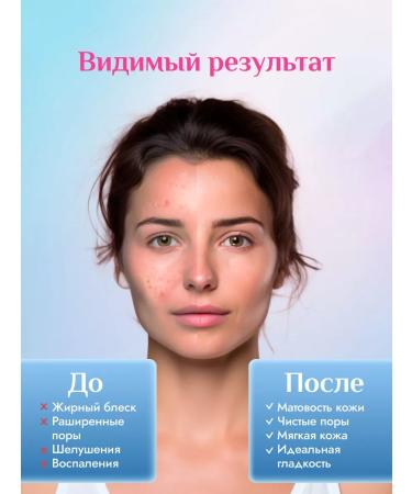 Etude House Wash foam Etude 160 gr - Buy Online on GoSupps.com