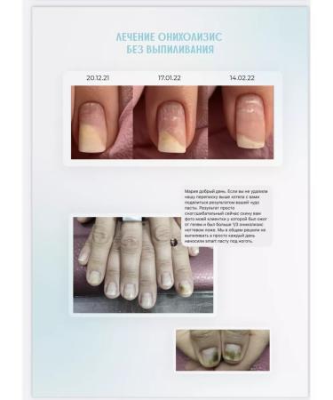 Smart Master Multipasta Smart Steak 10 ml from onycholysis nail fungus - Buy Online on GoSupps.com