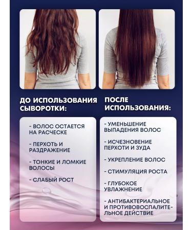 Adesso Serum - Hair growth lotion - Buy Online on GoSupps.com