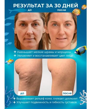 LIFE HUB Collagen for joints and hair in capsules - Buy Online on GoSupps.com