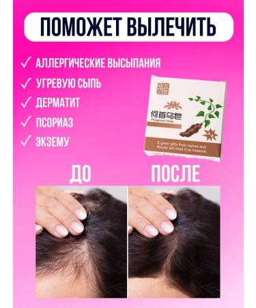 Alindi Solid shampoo for hair soap strengthening - Buy Online on GoSupps.com