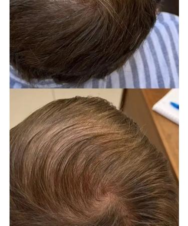 Perfotesoro Hair growth serum - Buy Online on GoSupps.com