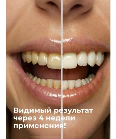 Klatz Toothpaste for girls without fluorine remineralizing 75 ml - Buy Online on GoSupps.com