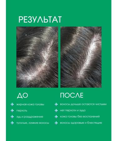 Sim Sensitive System 4 shampoo for oily hair and from dandruff No. 1 500 ml - Buy Online on GoSupps.com