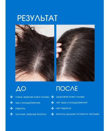 Sim Sensitive System 4 shampoo for very oily hair from dandruff No. 4 500 ml - Buy Online on GoSupps.com