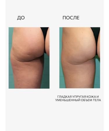 Lamar Professional Cream Anti -cellulite Hot Pepper 500 g - Buy Online on GoSupps.com