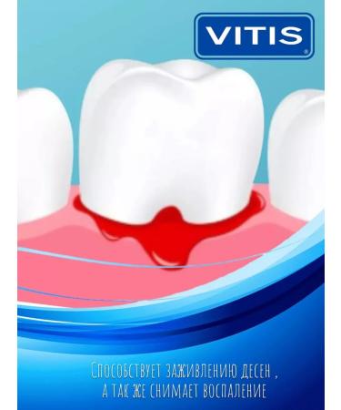 VITIS Set of orthodontic toothpaste 100 ml - Buy Online on GoSupps.com