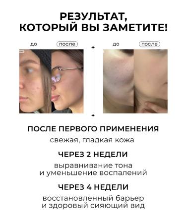 SelfLoveMedical Set of cleansing moisturizing facial masks - Buy Online on GoSupps.com